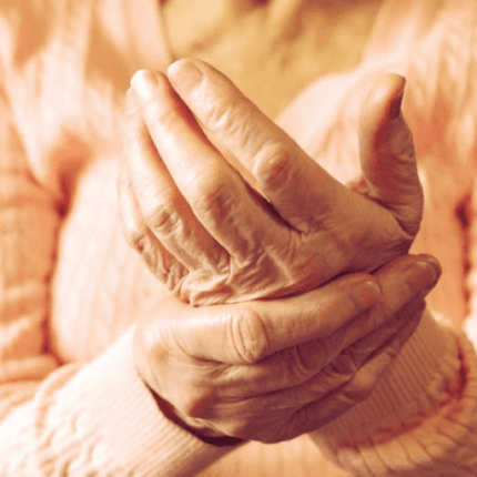 Rheumatoid Arthritis