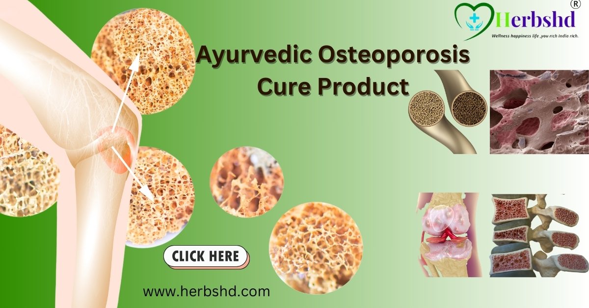 Ayurvedic Osteoporosis Cure Products