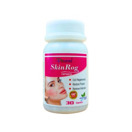 Order Now Ayurvedic Skin Rog Capsule for charmo rog, dry skin, peeling skin, remove infection, restore protein, cell regenerator, discolored skin patches