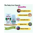 Order Now Ayurvedic Fatty Liver Capsule for strengthens liver, defeats jaundice, normalizes liver, balances urea, removes toxins as hrbshd.com
