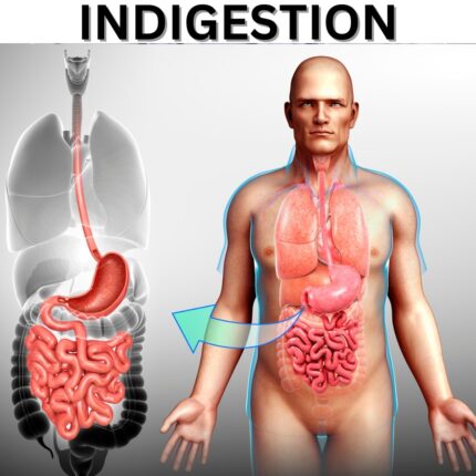 INDIGESTION